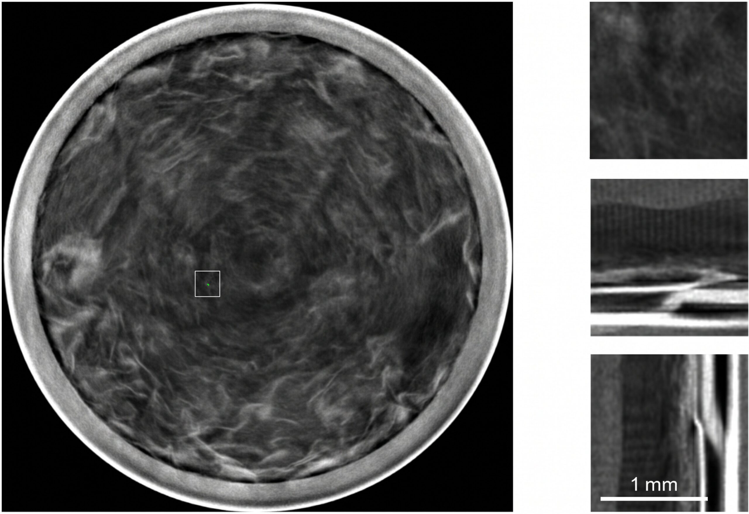 Conductor CT case showing folded and overlapping structures around possible defect indications