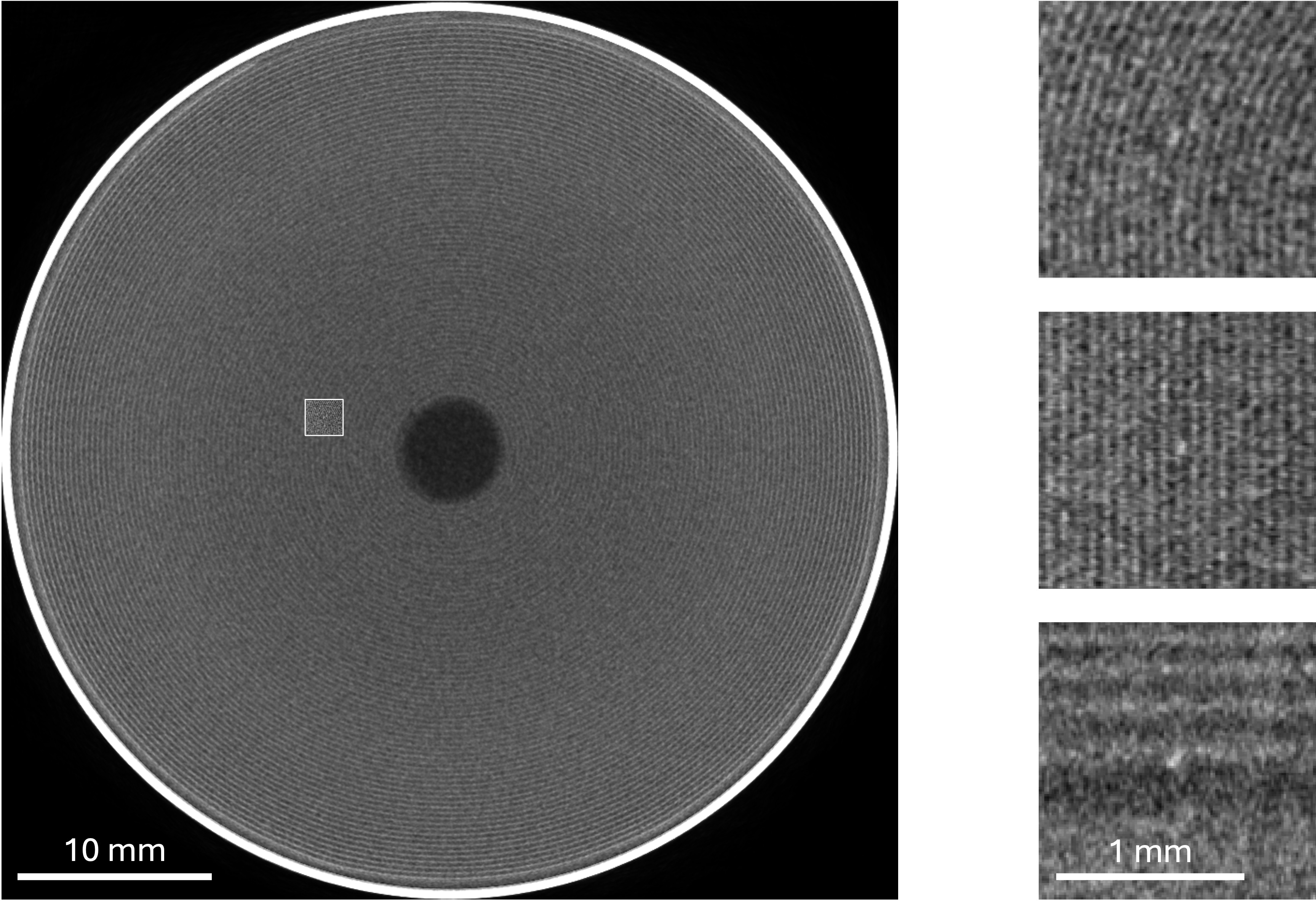 Jelly-roll CT case showing how a small inclusion can blend into background noise
